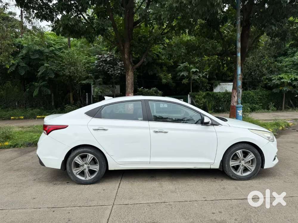 Hyundai Verna Crdi 2019 Sx Top Modal
