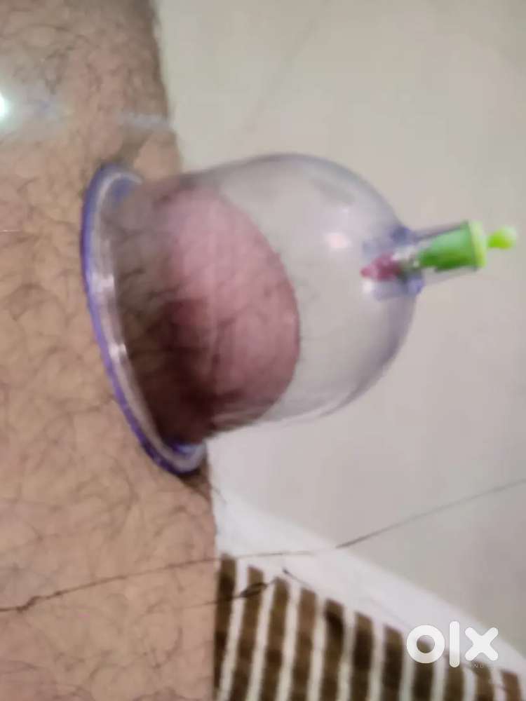 Cupping therapy hijama