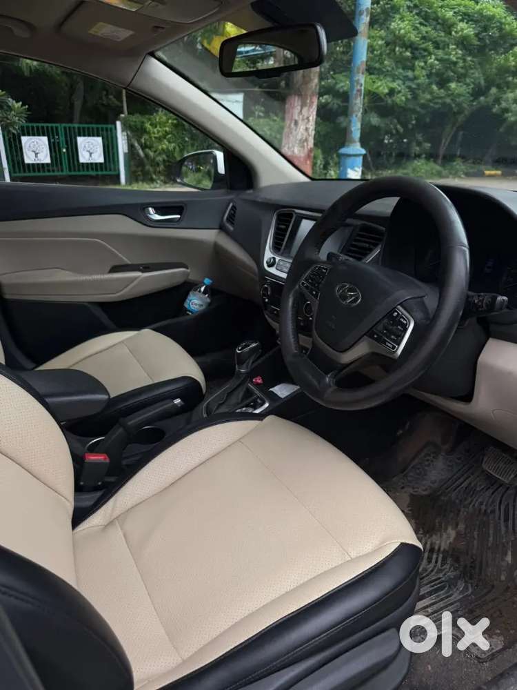 Hyundai Verna Crdi 2019 Sx Top Modal