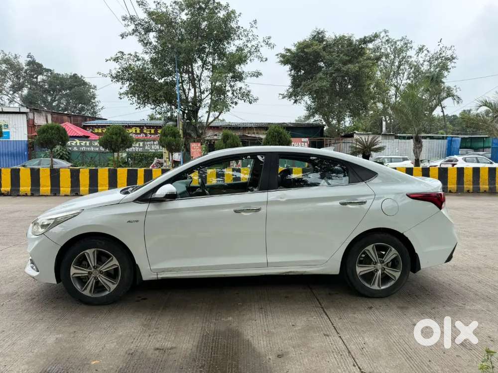 Hyundai Verna Crdi 2019 Sx Top Modal