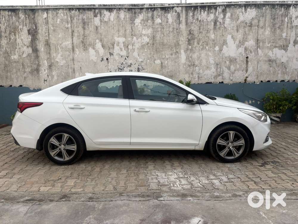 Hyundai Verna (sx) Diesel 2018