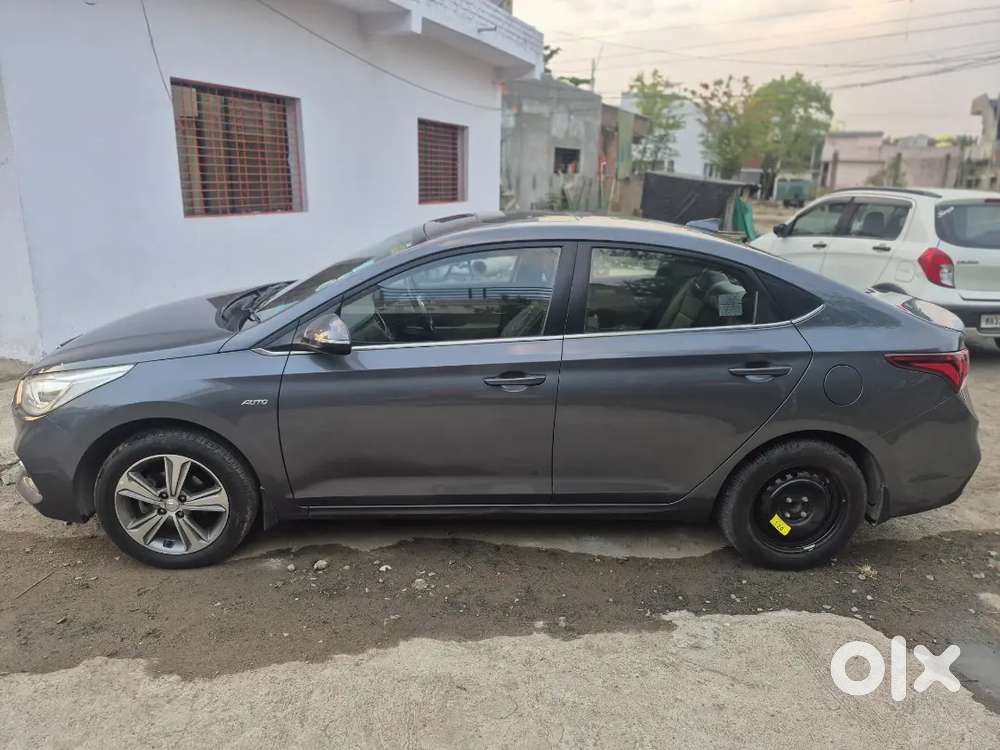 Hyundai Verna 2017 Sx Top Model Sunroof Diesel Well Maintained