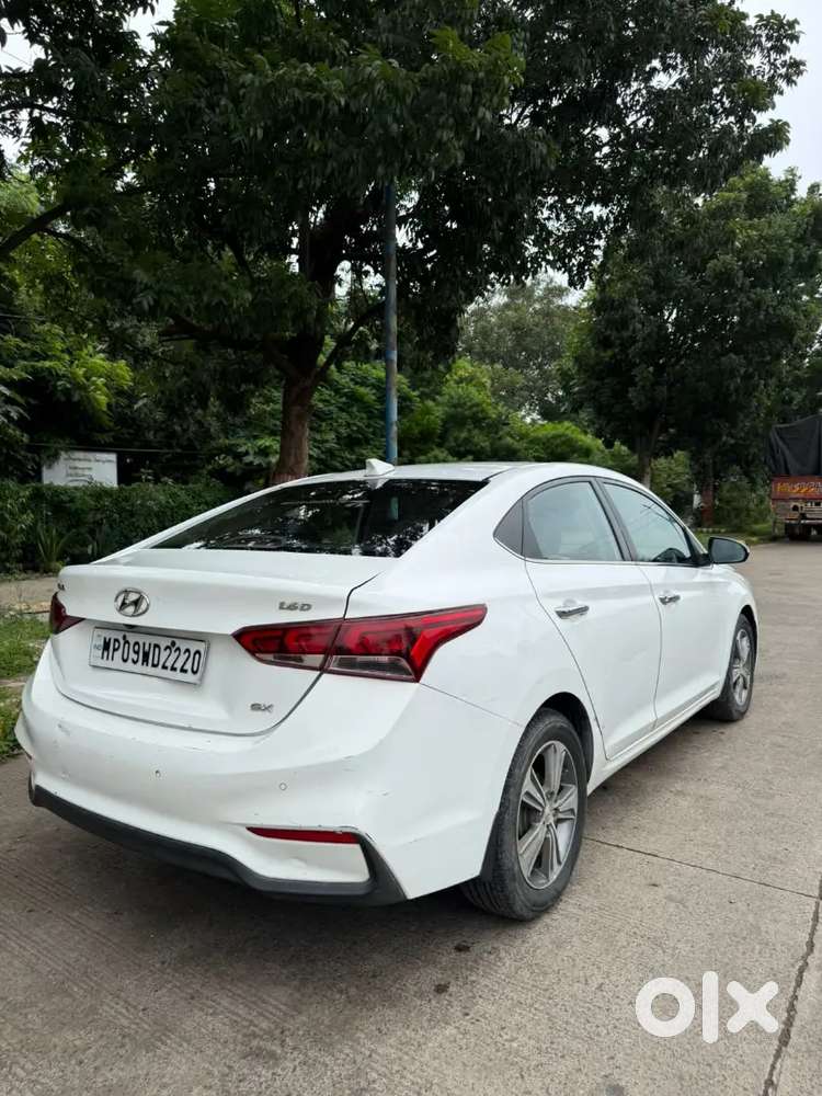 Hyundai Verna Crdi 2019 Sx Top Modal