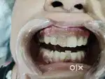 Dental assistant