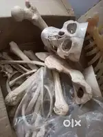 Bilateral Bone set