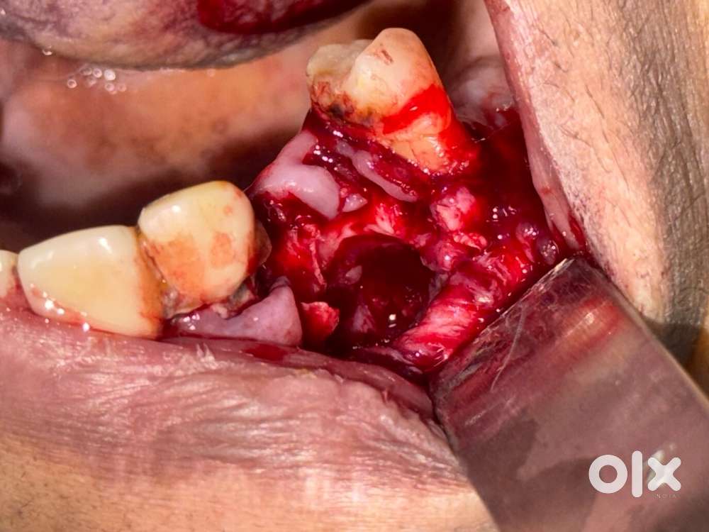 Driver / surgical assistant