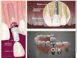 Dental assistant