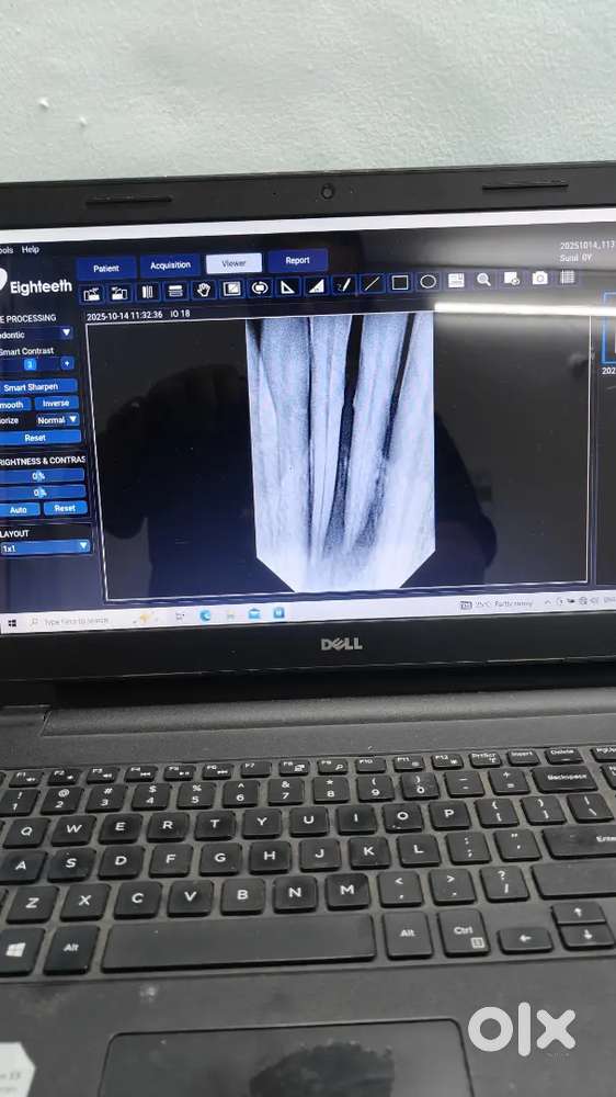 Female assistant required for dental clinic in Vijayanagar 4th stage