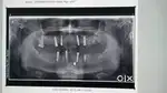 Dental assistant