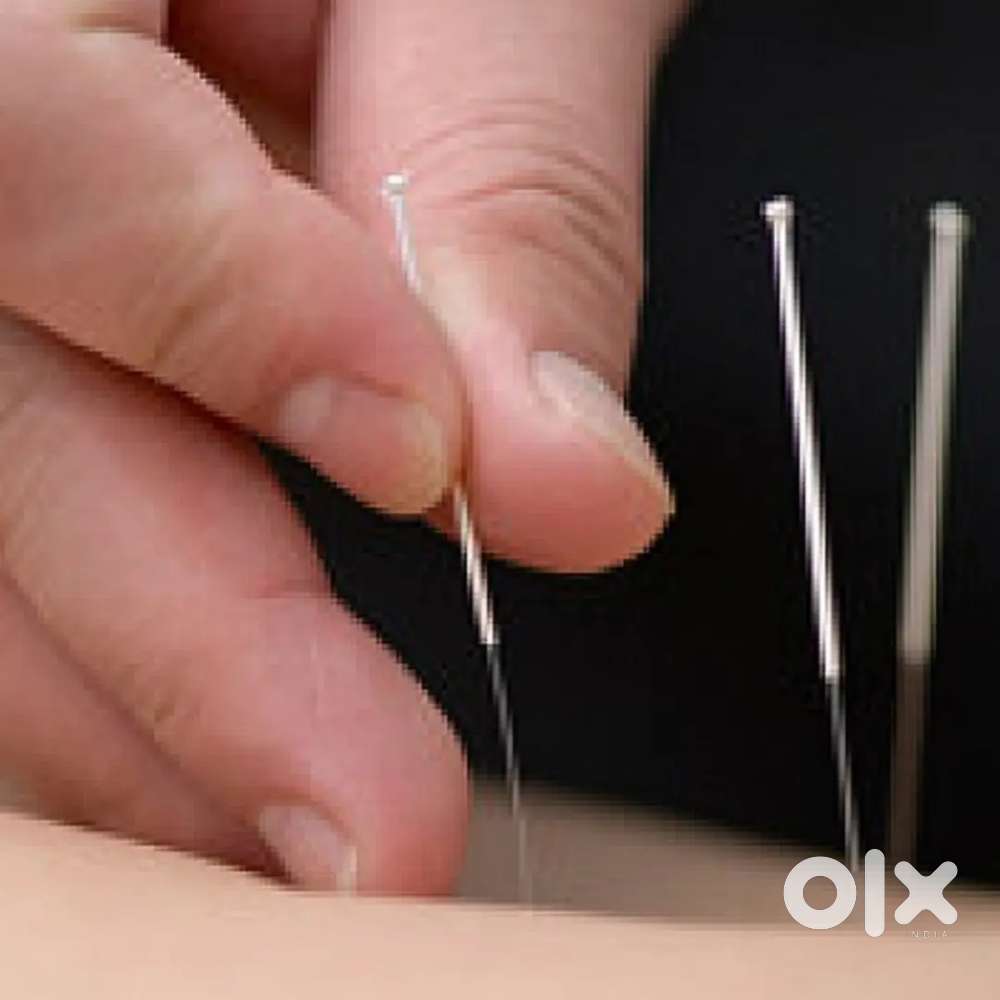 Acupuncture therapist