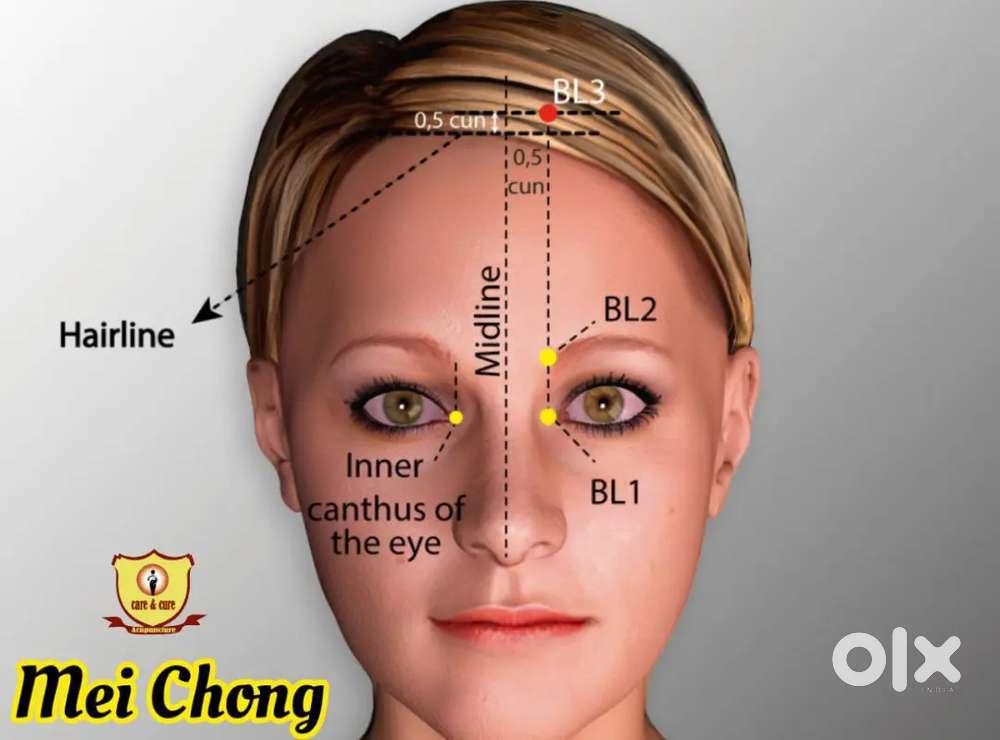 Jejo Reflex And Essence Acupuncture