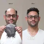 Hair patches and hair wig