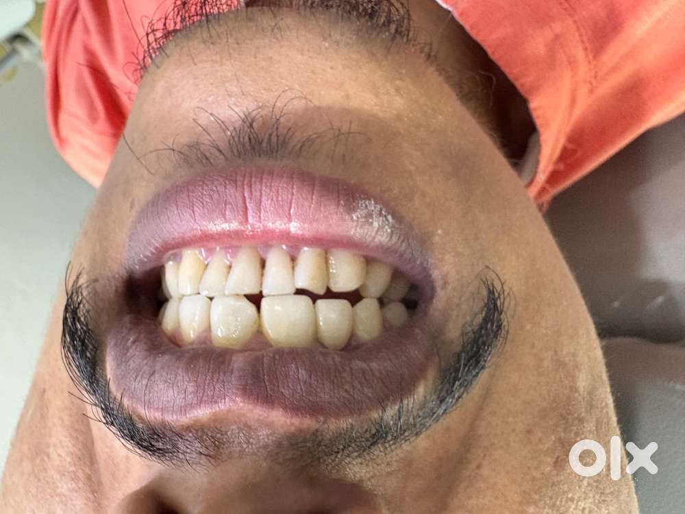 Dental assistant cum receptionist