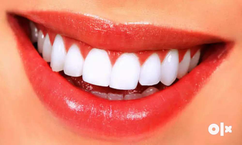 Rs.40 'शासनमान्य' Pearly Shine Denticare तपासणी Fees Only !