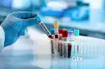 Looking for Lab technician job