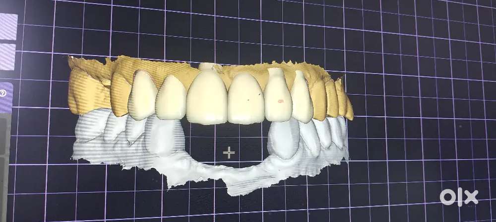 Need boy /girl for dental lab