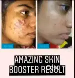 Skin regarding