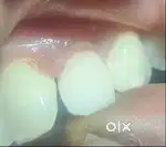 dental nurse