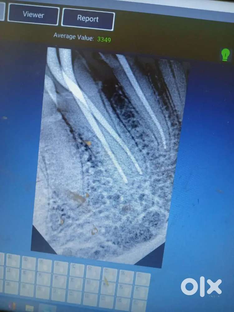 Required General dentist expert in Rct