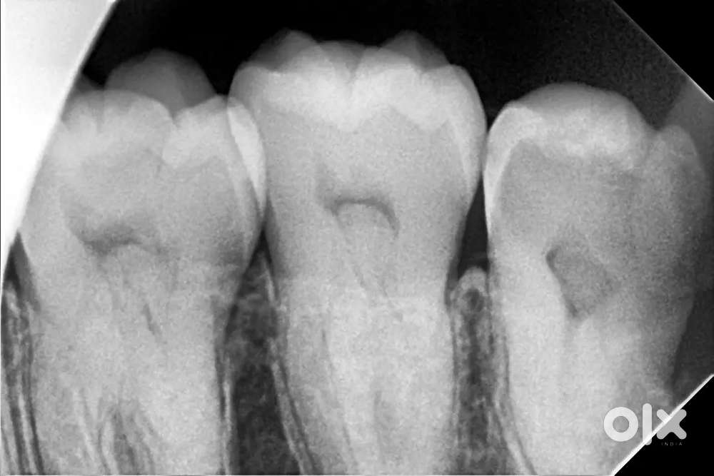 मौर्या डेंटल केयर में एक पुरूष कंपाउंडर स्टाफ का job है।