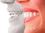 Receptionist cum dental assistance