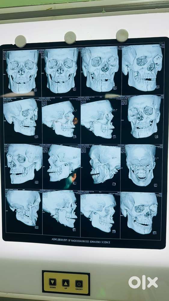 Medical OT job for freshers