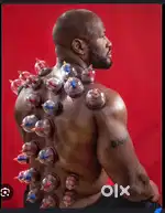 Cupping Therapy
