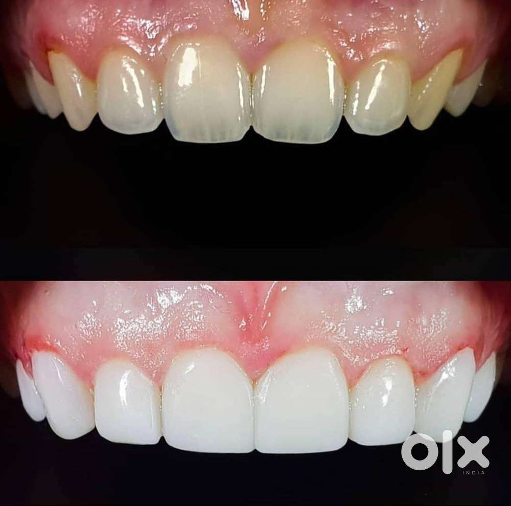 Need Assistant for Dental clinic- Only boy