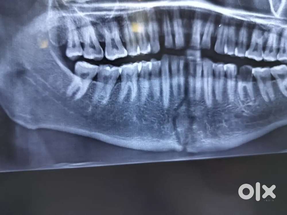 Dental assistant required female