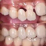 Wanted Chair side Assistant to work in a dental clinic in Srikakulam
