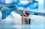 Phlebotomist/Staff Nurse ANM or GNM