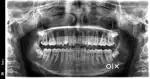 Dental assistant