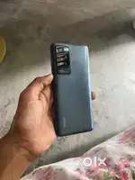 Redmi 10 Prime