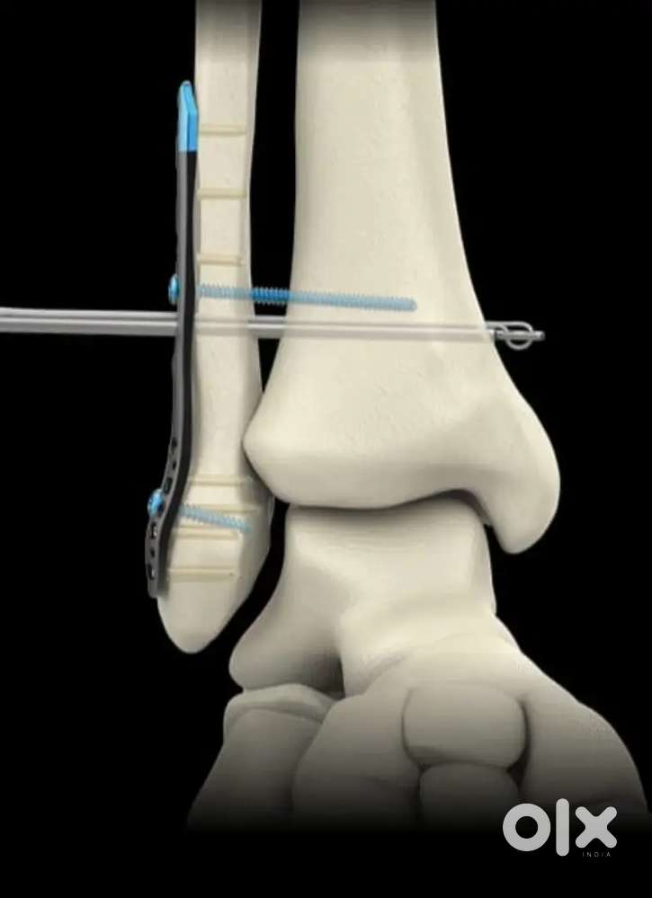 Delivery asst medical equipement