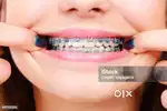 Dental Assistant
