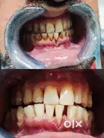Free Dental Checkup