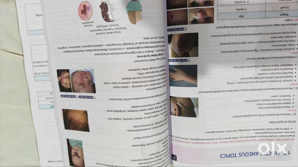 Prepladder rapid revision reignite notes 4 Volumes