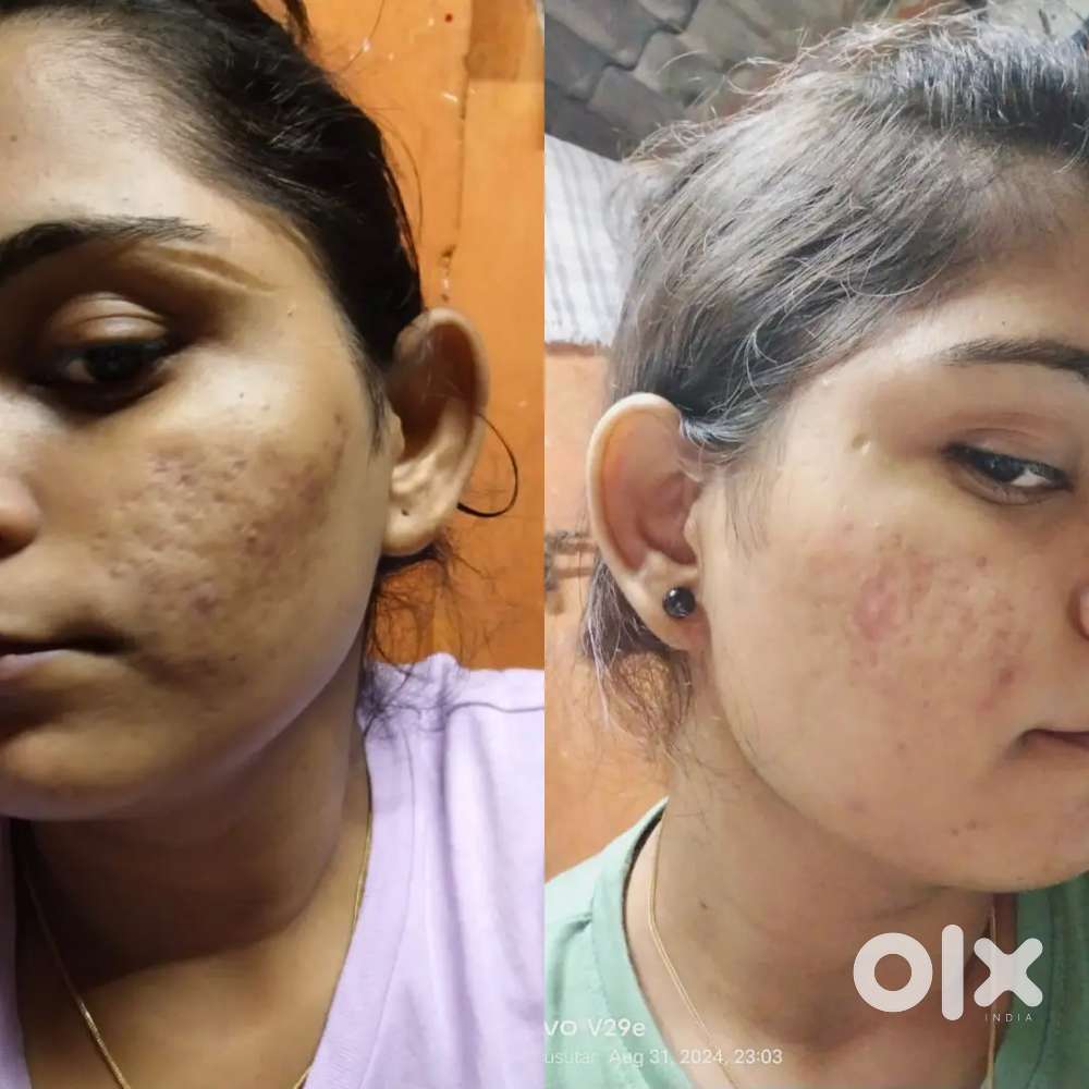 Fairness night cream chemical free retail/wholesale price