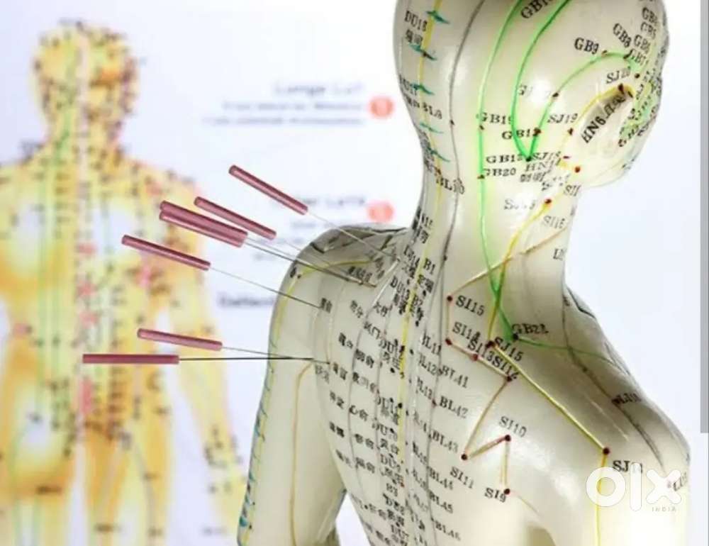 Acupressure and acupuncture