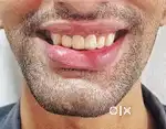 Dental Assistant needed