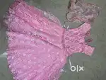 Baby frock