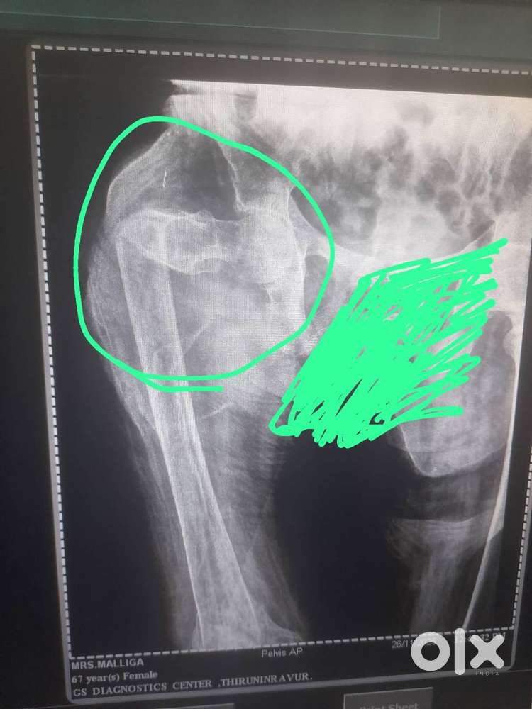 Care taker for 63year old