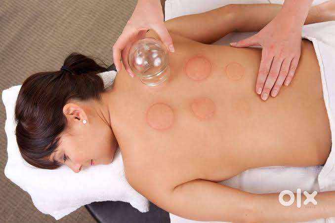 Dry Cupping