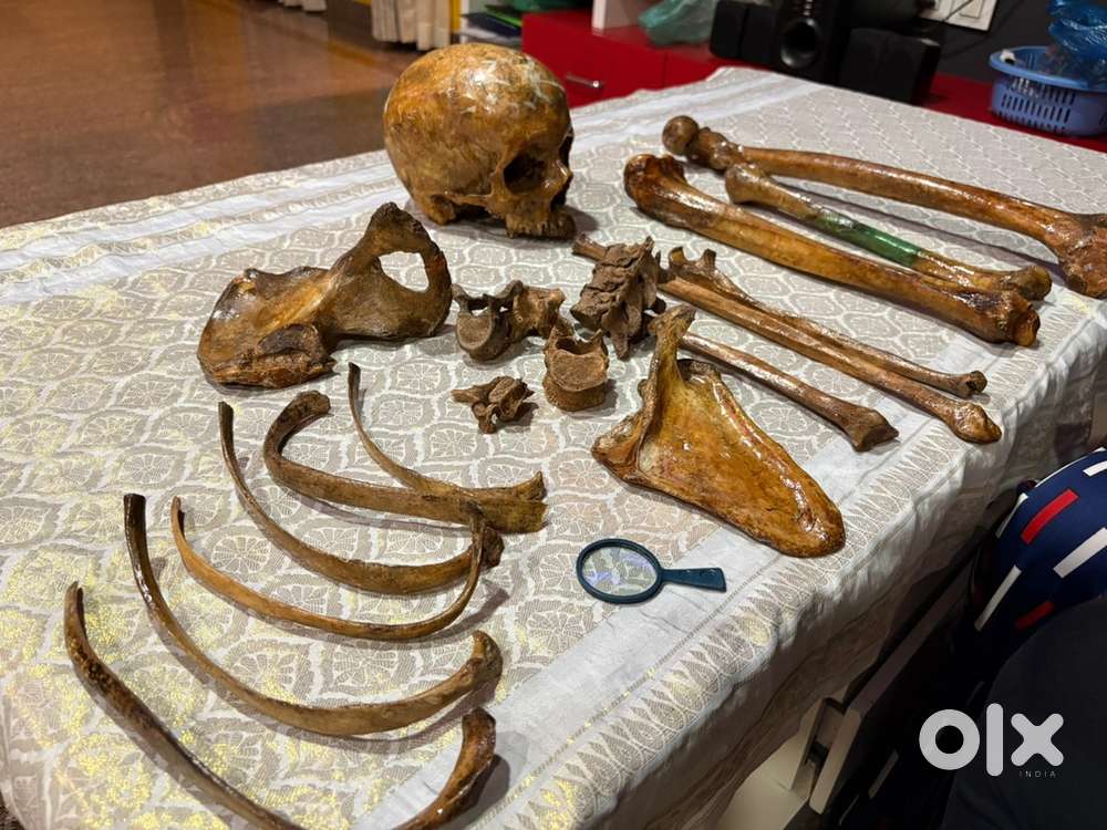 Bone set MBBS