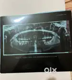 ഡെന്റൽ അസിസ്റ്റാന്റിൻറെ ആവിശ്യം ഉണ്ട്