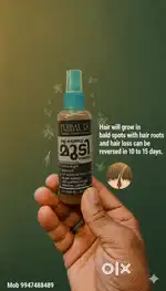 You can grow hair on bald spots with hair roots