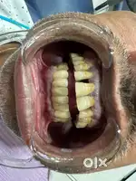 Dental assistant