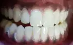 Dental chair side Assistant-female