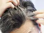 सफेद बालों को जड़ से काले करें (call)