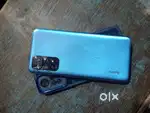 Redmi note 11s